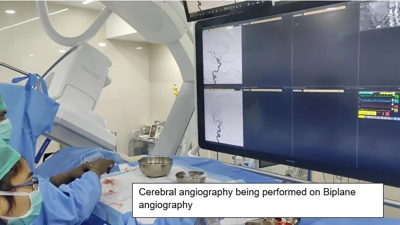 Cerebral Angiography DSA with Bi-Plane Technology